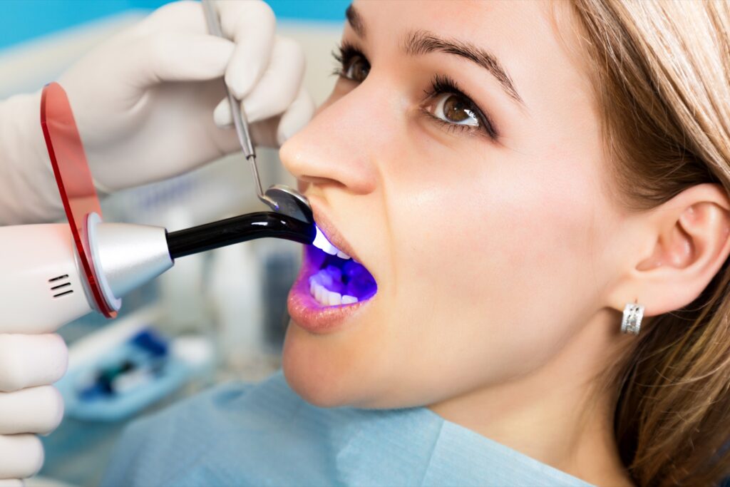 Read more on Answering the Most Commonly Asked Questions About Fillings