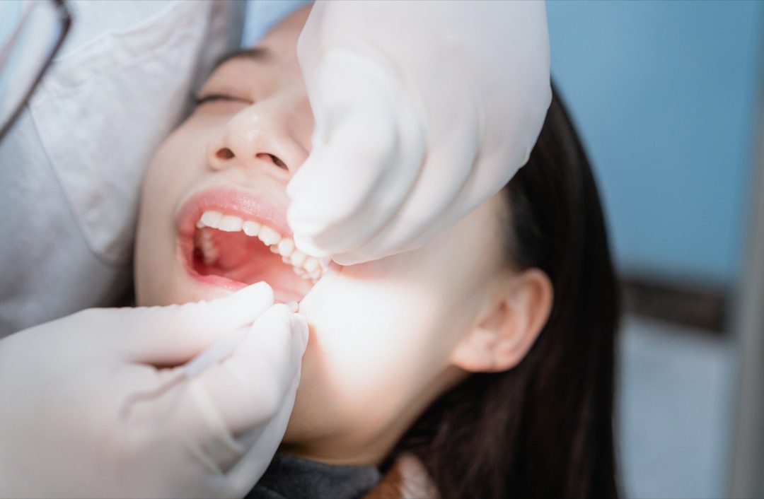 Woman having consultation for wisdom teeth