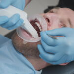 Digital Dental Impressions: Accuracy & Benefits