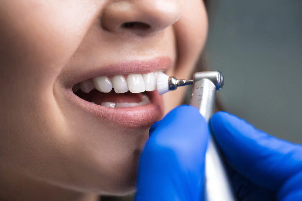How much is a dental cleaning in bc