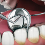 Dental Hygiene in Penticton: Your Guide to a Brighter Smile