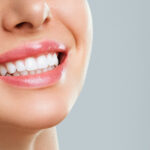 Teeth Whitening in Penticton This Summer: A Brighter Smile