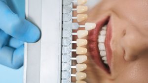 Read more on White Spots on Teeth: Causes, Prevention & Treatment